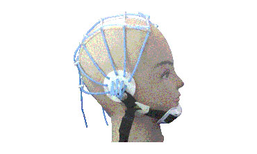 General Bracket electrode Cap