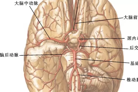 Application of neurophysiological monitoring in carotid endarterectomy
